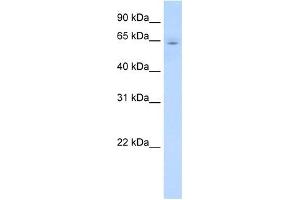 CYP2E1 antibody used at 1 ug/ml to detect target protein. (CYP2E1 Antikörper  (C-Term))
