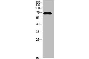 Western blot analysis of MCF7 SW480 MOUSE-LIVER mouse-lung MOUSE-KIDNEY lysate, antibody was diluted at 500. (IL16 Antikörper  (AA 900-960))