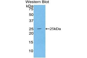 Western blot analysis of the recombinant protein. (ADH1 Antikörper  (AA 169-370))