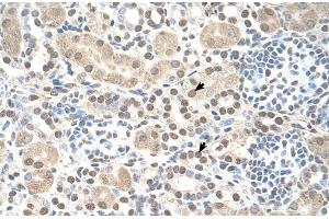 Human kidney (ST8SIA2 Antikörper  (C-Term))