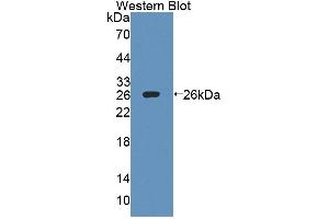 Figure. (IL27 Receptor alpha Antikörper  (AA 93-273))