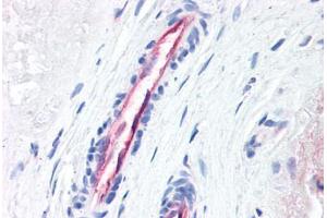 Human Placenta, Vessels (formalin-fixed, paraffin-embedded) stained with F2R antibody ABIN337370 at 10 ug/ml followed by biotinylated anti-mouse IgG secondary antibody ABIN481714, alkaline phosphatase-streptavidin and chromogen.