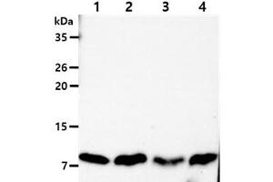 The Cell lysates (40ug) were resolved by SDS-PAGE, transferred to PVDF membrane and probed with anti-human DYNLL antibody (1:1000). (DYNLL1 Antikörper)