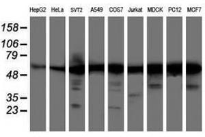 Image no. 1 for anti-V-Akt Murine Thymoma Viral Oncogene Homolog 1 (AKT1) antibody (ABIN1496558) (AKT1 Antikörper)