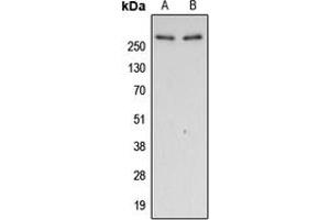 Western blot analysis of Filamin A (pS2152) expression in HeLa calyculin A-treated (A), A431 EGF-treated (B) whole cell lysates. (Filamin A Antikörper  (C-Term, pSer2152))