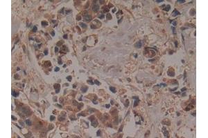 Immunohistochemistry (IHC) image for anti-Glutamate-Cysteine Ligase, Modifier Subunit (GCLM) (AA 40-251) antibody (ABIN7433051)
