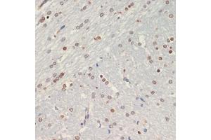 Immunohistochemistry of paraffin-embedded rat brain using Olig2 antibody (ABIN6128396, ABIN6145015, ABIN6145016 and ABIN6216575) at dilution of 1:200 (40x lens). (OLIG2 Antikörper  (AA 1-80))