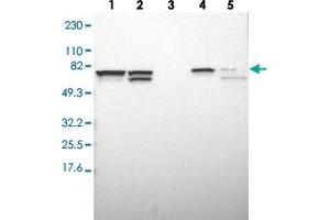 Western blot analysis of Lane 1: RT-4, Lane 2: U-251 MG, Lane 3: Human Plasma, Lane 4: Liver, Lane 5: Tonsil with SETD3 polyclonal antibody  at 1:250-1:500 dilution.
