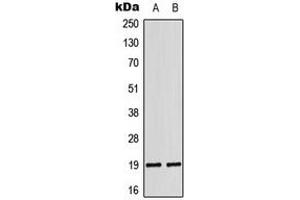Western blot analysis of LATH expression in DU145 (A), K562 (B) whole cell lysates. (LATH Antikörper  (Center))