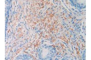 IHC-P analysis of Human Prostate Gland Tissue, with DAB staining. (HIST1H2AG Antikörper  (AA 1-130))