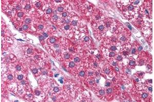 Immunohistochemistry (Paraffin-embedded Sections) (IHC (p)) image for anti-Purinergic Receptor P2X, Ligand Gated Ion Channel 2 (P2RX2) (AA 55-104) antibody (ABIN6736419)
