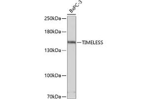 Western blot analysis of extracts of BxPC-3 cells, using TIMELESS antibody (ABIN1683038, ABIN3018743, ABIN3018744 and ABIN6220565) at 1:3000 dilution. (TIMELESS Antikörper  (AA 969-1208))