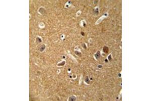 Formalin fixed, paraffin embedded human brain tissue stained with DAGLA Antibody  followed by peroxidase conjugation of the secondary antibody and DAB staining. (DAGLA Antikörper  (Middle Region))