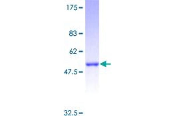 RAB27B Protein (AA 1-218) (GST tag)