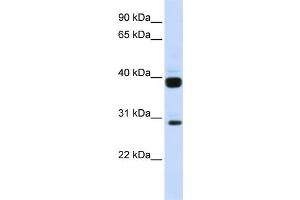 WB Suggested Anti-FLT3LG Antibody Titration:  0. (FLT3LG Antikörper  (N-Term))