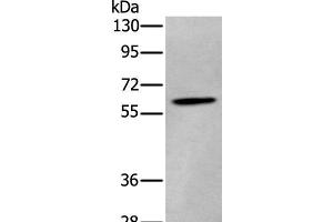 Western blot analysis of Human cerebrum tissue lysate using ZKSCAN1 Polyclonal Antibody at dilution of 1:400 (ZKSCAN1 Antikörper)