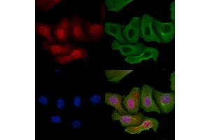 ABIN6263031 and ABIN6269112 staining Hela cells by IF/ICC.