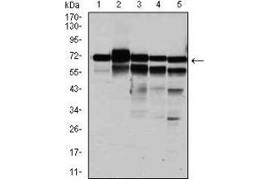 Western blot analysis using RPA1 mouse mAb against HeLa (1), MCF-7 (2), K562(3), A431(4), and COS-7 (6) cell lysate. (RPA1 Antikörper)