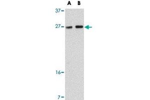 Western blot analysis of TMEM18 in rat brain tissue lysate with TMEM18 polyclonal antibody  at (A) 0. (Transmembrane Protein 18 (TMM18) (C-Term) Antikörper)