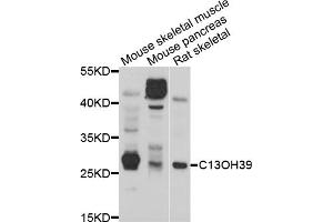 Western blot analysis of extracts of various cell lines, using METTL21C antibody (ABIN5998216) at 1/1000 dilution. (METTL21C Antikörper)