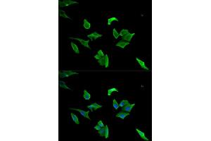 Immunofluorescence (IF) image for anti-Lymphocyte Cytosolic Protein 1 (LCP1) antibody (ABIN1876741) (LCP1 Antikörper)