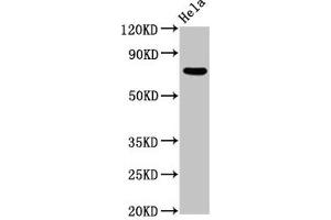 Western Blot Positive WB detected in: Hela whole cell lysate All lanes: MTMR2 antibody at 5. (MTMR2 Antikörper  (AA 1-173))