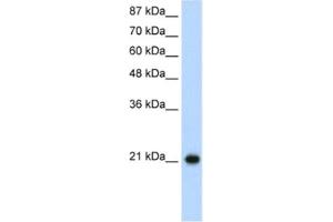 Western Blotting (WB) image for anti-Ribosomal Protein L9 (RPL9) antibody (ABIN2462051)