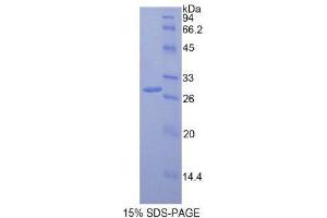 SDS-PAGE (SDS) image for Multimerin 1 (MMRN1) (AA 846-1084) protein (His tag) (ABIN2121652) (Multimerin 1 Protein (MMRN1) (AA 846-1084) (His tag))