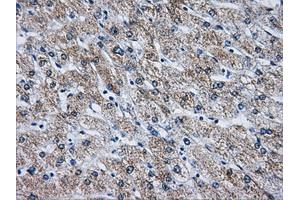 Immunohistochemical staining of paraffin-embedded liver tissue using anti-ATP5B mouse monoclonal antibody. (ATP5B Antikörper)