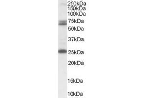 ABIN185388 (0. (GAD65 Antikörper  (Internal Region))