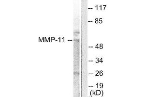 Western Blotting (WB) image for anti-Matrix Metallopeptidase 11 (Stromelysin 3) (MMP11) (Internal Region) antibody (ABIN1848672) (MMP11 Antikörper  (Internal Region))