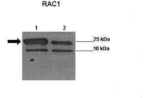Sample Type: Lane 1:241 µg siRUVBL1 transfected human H1299 cells Lane 2: 041 µg untransfected human H1299 cells Primary Antibody Dilution: 1:0000Secondary Antibody: Anti-rabbit-HRP Secondary Antibody Dilution: 1:0000 Color/Signal Descriptions: RAC1  Gene Name: Wenwei Hu, Xuetian Yue, Rutgers Cancer Institute of New Jersey. (RAC1 Antikörper  (Middle Region))