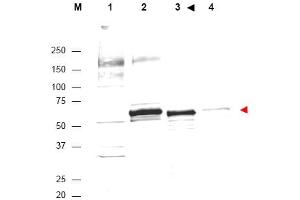Image no. 1 for anti-V-Akt Murine Thymoma Viral Oncogene Homolog 1 (AKT1) (Internal Region) antibody (ABIN401484) (AKT1 Antikörper  (Internal Region))