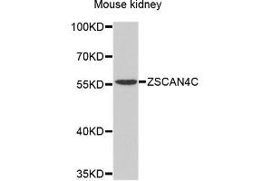 Western blot analysis of extracts of mouse kidney, using ZSCAN4 antibody.