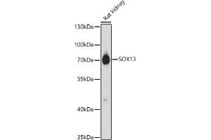 Western blot analysis of extracts of Rat kidney, using SOX13 antibody (ABIN7270570) at 1:1000 dilution. (SOX13 Antikörper  (AA 1-180))