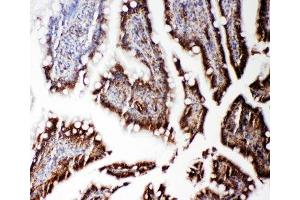 IHC-P: RGS3 antibody testing of rat intestine tissue (RGS3 Antikörper  (C-Term))