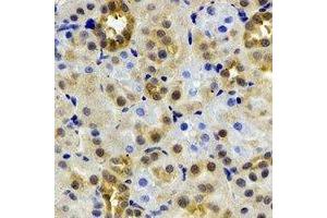 Immunohistochemical analysis of ADH4 staining in rat kidney formalin fixed paraffin embedded tissue section. (ADH4 Antikörper)