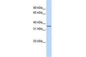 Image no. 1 for anti-T-Cell Leukemia Homeobox 1 (TLX1) (AA 144-193) antibody (ABIN6741503)