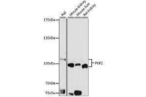 Western blot analysis of extracts of various cell lines, using PKP2 antibody (ABIN1876693) at 1:1000 dilution. (Plakophilin 2 Antikörper)