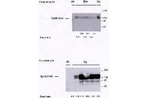 Image no. 1 for anti-EPH Receptor B1 (EPHB1) antibody (ABIN264959) (EPH Receptor B1 Antikörper)