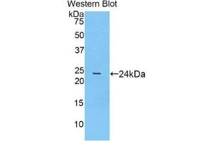 Western Blotting (WB) image for anti-Prostaglandin-Endoperoxide Synthase 1 (Prostaglandin G/H Synthase and Cyclooxygenase) (PTGS1) (AA 407-602) antibody (ABIN1860352) (PTGS1 Antikörper  (AA 407-602))