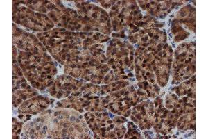 Image no. 4 for anti-Spermidine/Spermine N1-Acetyltransferase 2 (SAT2) antibody (ABIN1500807)