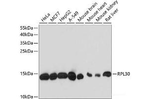 Western blot analysis of extracts of various cell lines using RPL30 Polyclonal Antibody at dilution of 1:3000. (RPL30 Antikörper)