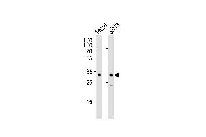 Western blot analysis of lysates from Hela, SiHa cell line (from left to right), using SNAI1 Antibody (N-term R8) (ABIN388812 and ABIN2839130). (SNAIL Antikörper  (N-Term))