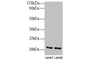 Western blot All lanes: ARF4 antibody at 2 μg/mL Lane 1: EC109 whole cell lysate Lane 2: 293T whole cell lysate Secondary Goat polyclonal to rabbit IgG at 1/15000 dilution Predicted band size: 21 kDa Observed band size: 21 kDa (ARF4 Antikörper  (AA 1-180))