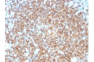 Immunohistochemistry (IHC) image for anti-CD22 Molecule (CD22) (AA 52-178) antibody (ABIN6941120)