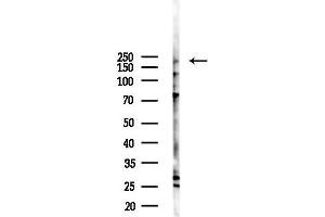 Western blot analysis of lysates from F10-LUC cells(starvation,24h treatment), using AS250 Antibody at 1/1000 dilution.