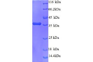 SDS-PAGE (SDS) image for Cyclin-Dependent Kinase 4 (CDK4) (AA 2-303) protein (His tag) (ABIN5712788)