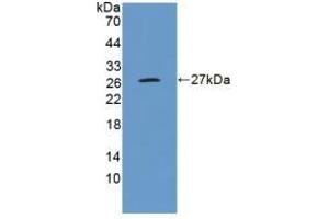 Detection of Recombinant GluAP, Human using Polyclonal Antibody to Aminopeptidase A (ENPEP) (ENPEP Antikörper  (AA 718-948))