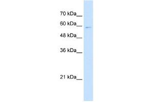 WB Suggested Anti-IRF4 Antibody Titration:  5.